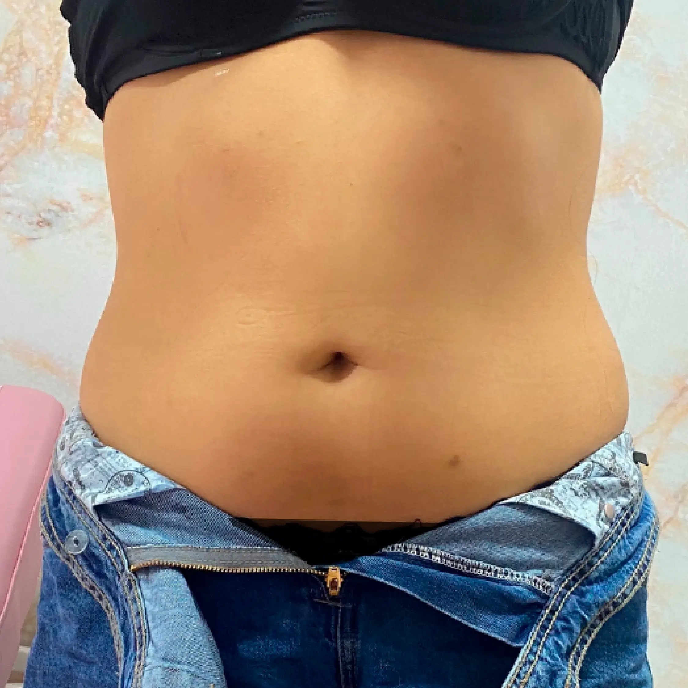 Después - Proyecto 3